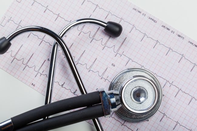 metal stethoscope on cardiogram